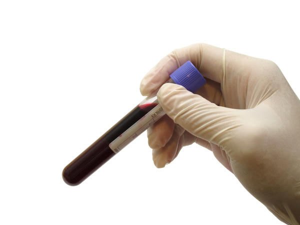 HIV Test before Conception